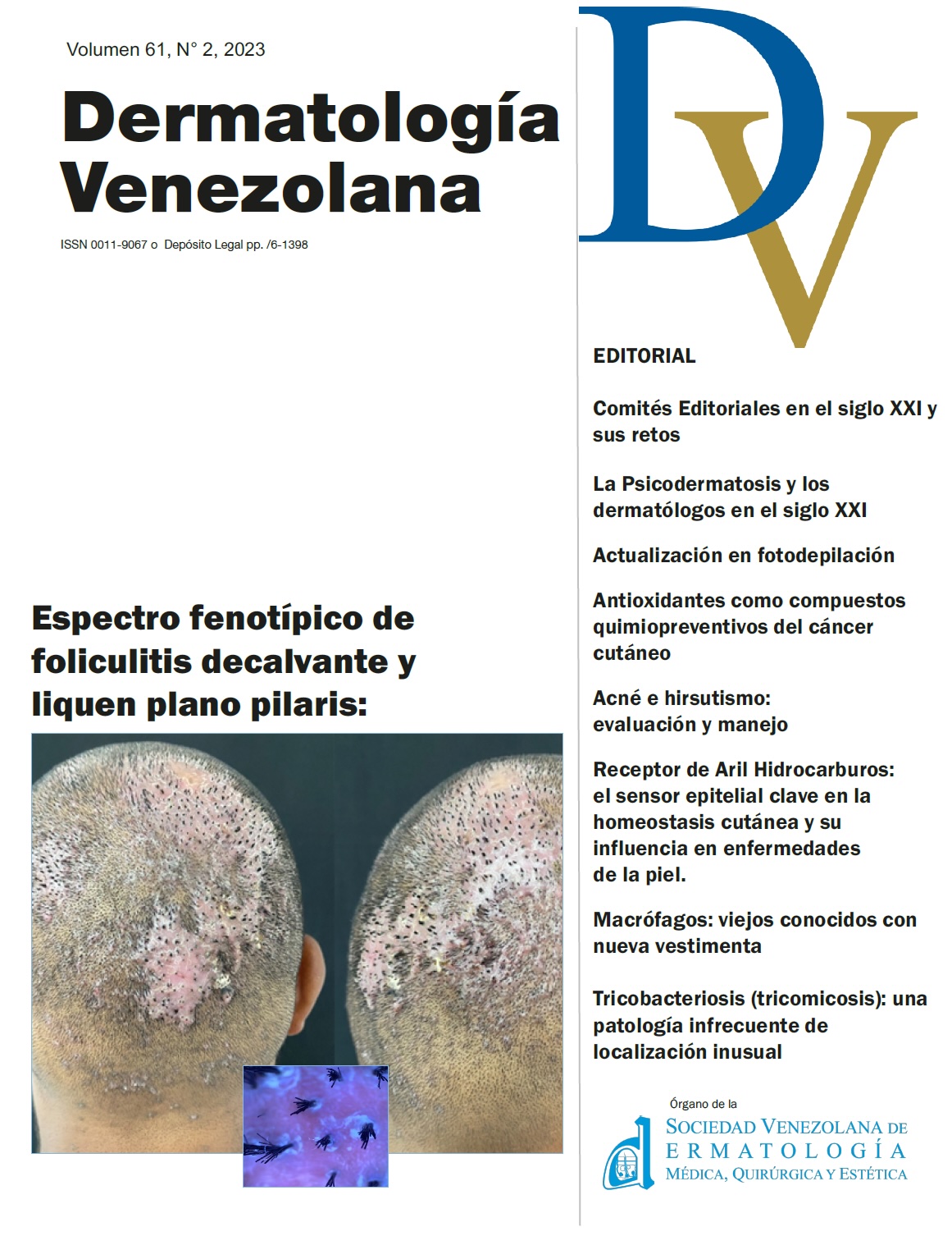 Portada