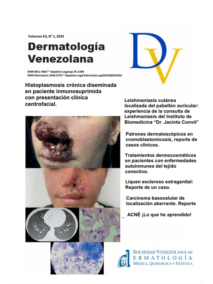 					Ver Vol. 63 Núm. 1 (2025): Dermatología Venezolana
				